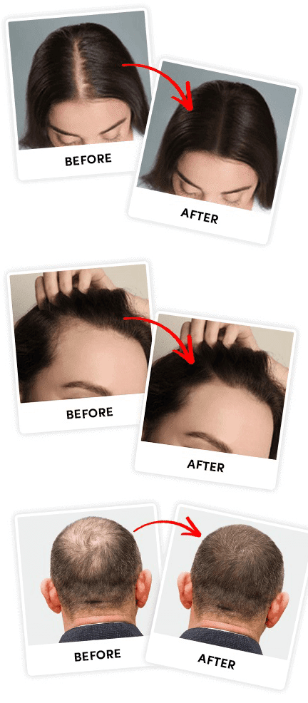 revitalize before after 1